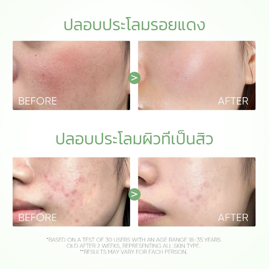 SKINTIFIC Mugwort Anti Pores & Acne Clay Stick